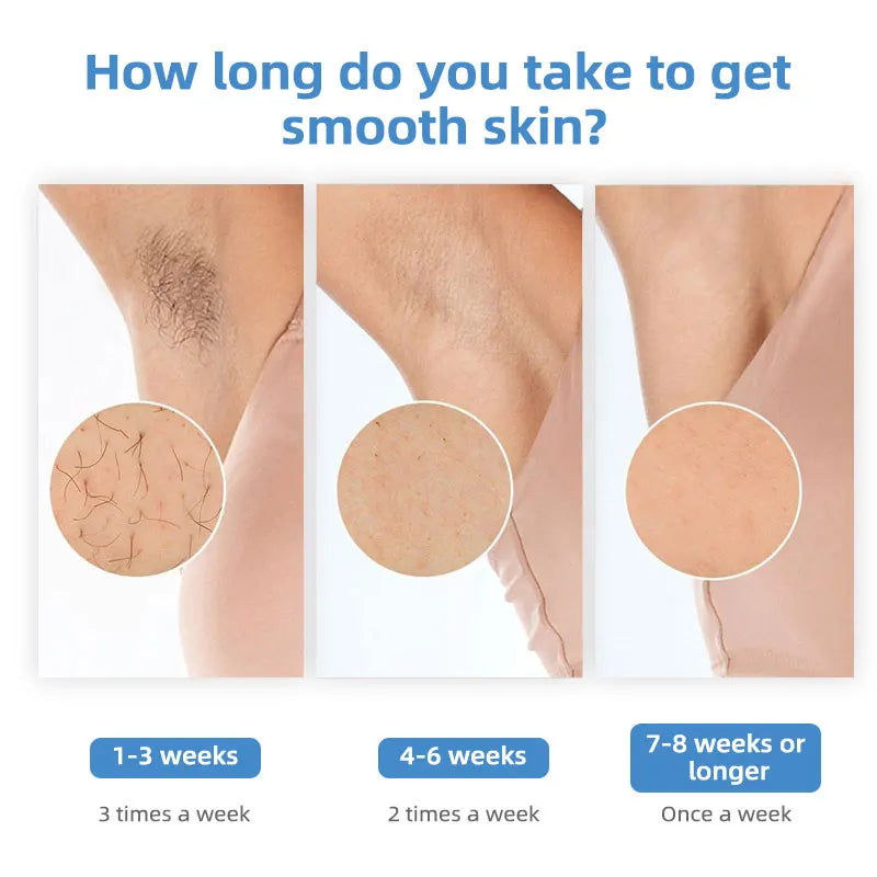 Ice Cooling Wholesale Direct Sales Hair Laser Device 2024 Best Selling IPL Hair Removal Popular Products Device